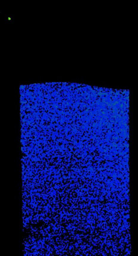posterframe for video
