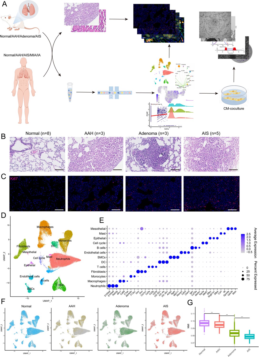 Ros.T ZDR-025 × 2 S100a4+ alveolar macrophages accelerate the progression of