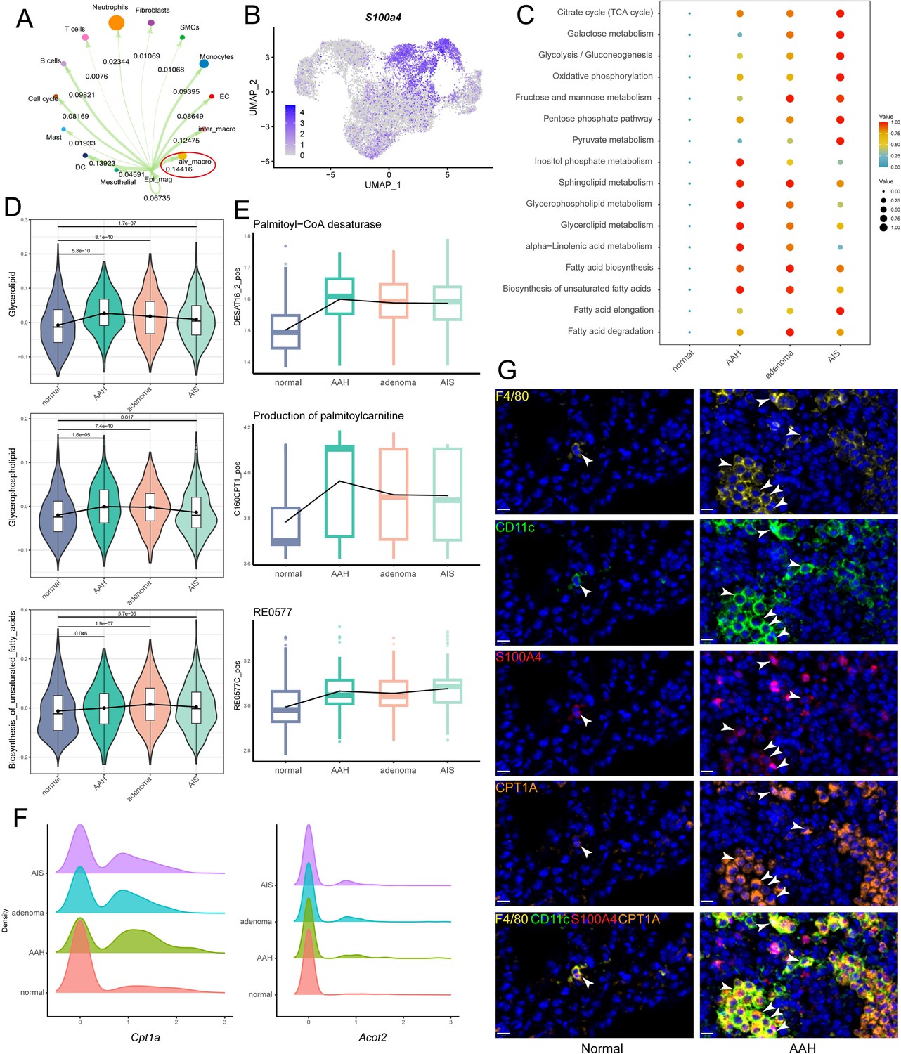 Ros.T ZDR-025 × 2 S100a4+ alveolar macrophages accelerate the progression of