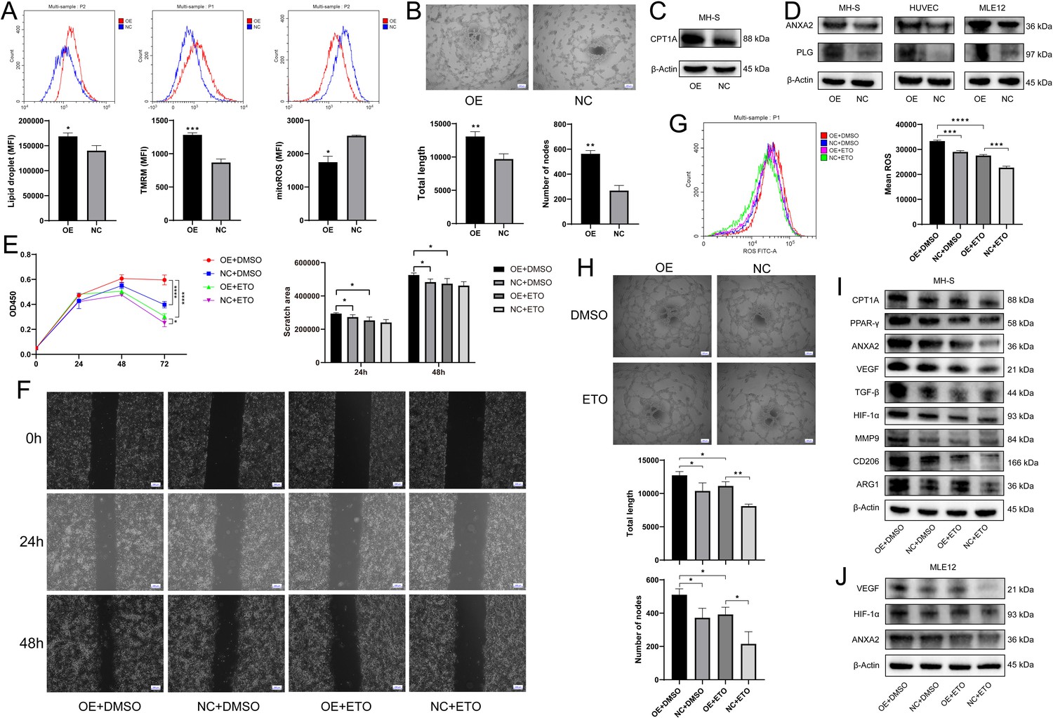 Ros.T ZDR-025 × 2 S100a4+ alveolar macrophages accelerate the progression of