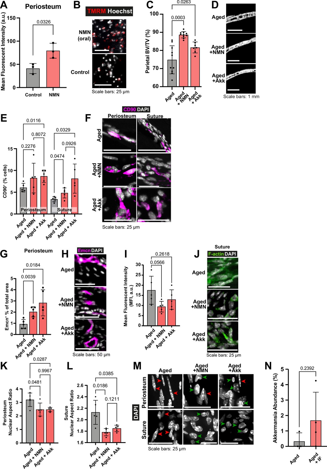 Rejuvenating aged osteoprogenitors for bone repair | eLife
