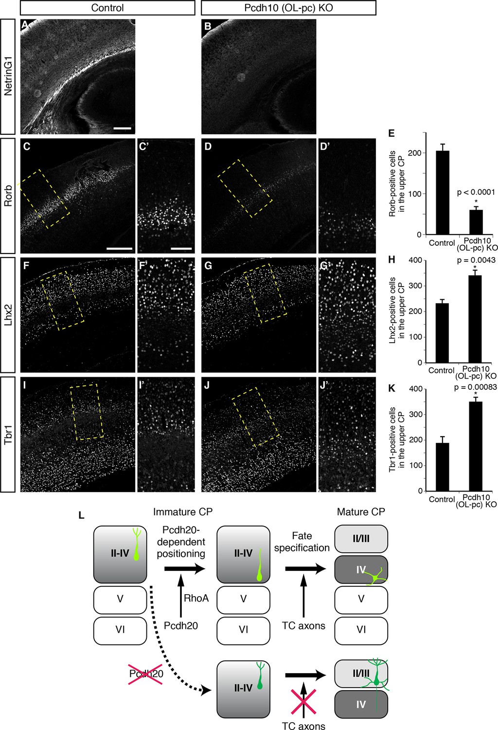 Research Identifies Complex Of Neurons Crucial To Controlling Attention >> Identity Of Neocortical Layer 4 Neurons Is Specified Through Correct Research Identifies Complex Of Neurons Crucial To Controlling Attention >> Identity Of Neocortical Layer 4 Neurons Is Specified Through Correct