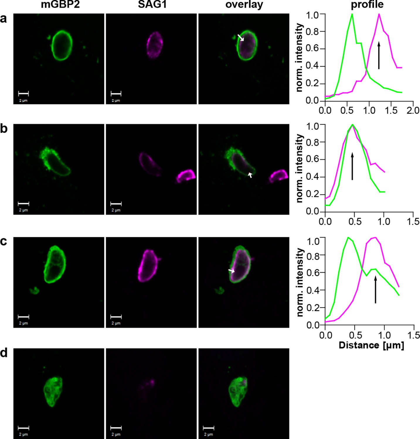 toxoplasma gondii video
