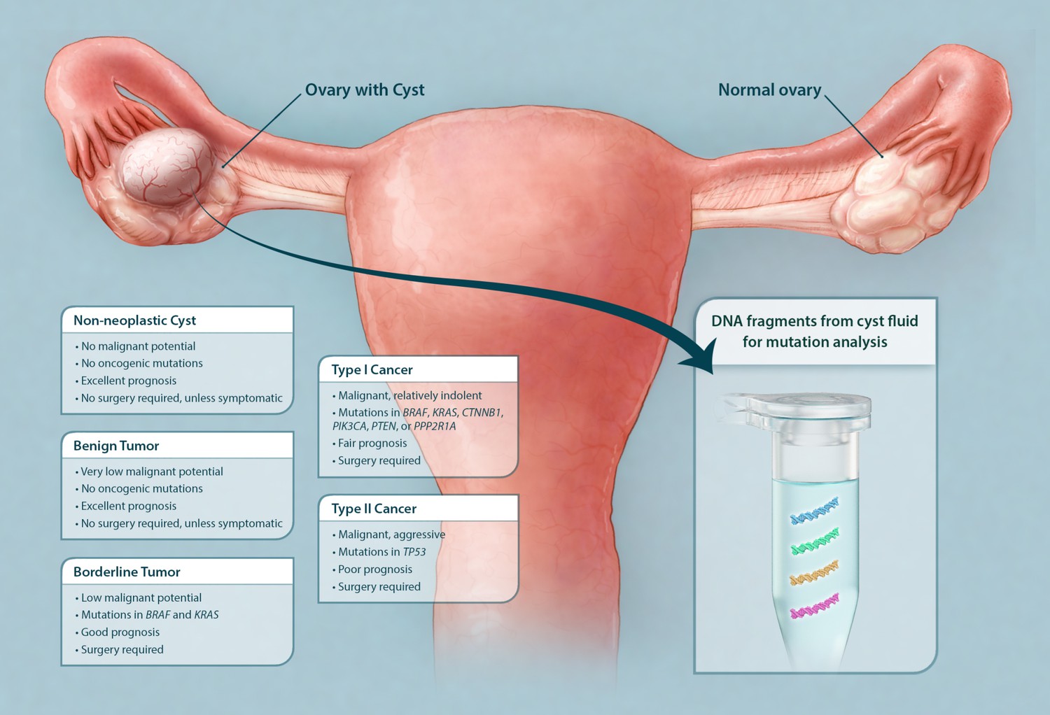 ovarian cancer vs cyst)