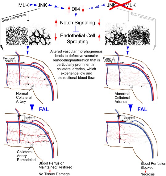 Suppression of ischemia in arterial occlusive disease by JNK-promoted ...