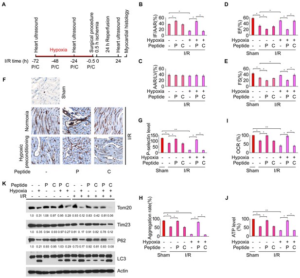 Hypoxic Mitophagy Regulates Mitochondrial Quality And Platelet 