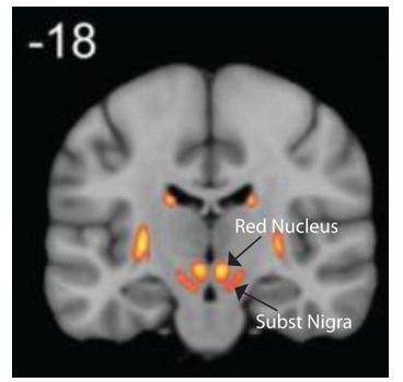 Anatomical and functional organization of the human substantia nigra