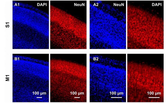 Electrical activity controls area-specific expression of neuronal ...