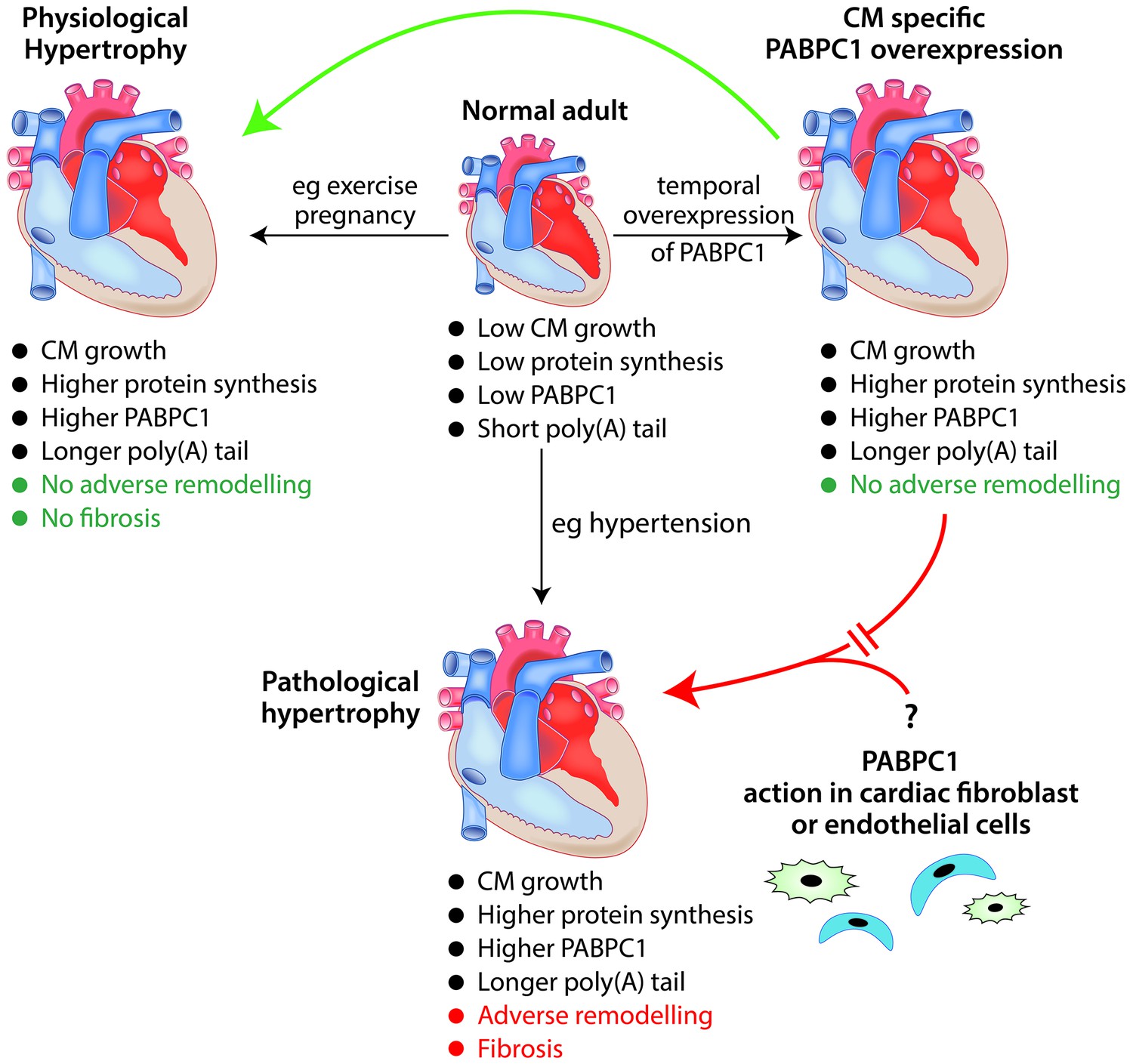 Cardiac Hypertrophy And Heart Failure