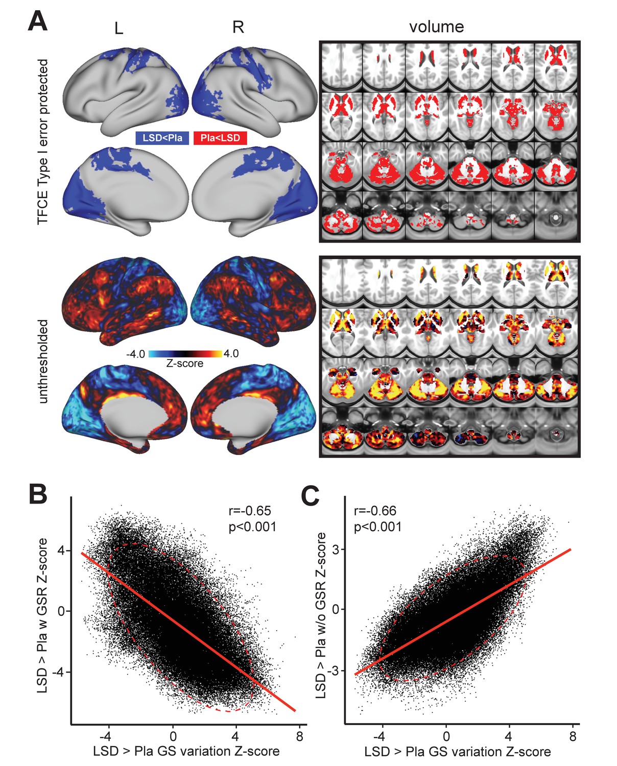 Changes In Global And Thalamic Brain Connectivity In Lsd Induced Altered States Of Consciousness Are Attributable To The 5 Ht2a Receptor Elife