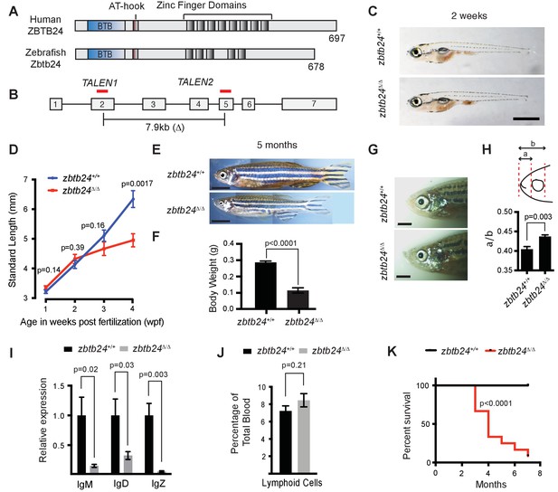 Pericentromeric hypomethylation elicits an interferon response in an ...