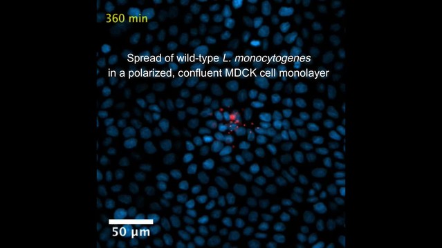 Listeria Monocytogenes Cell To Cell Spread In Epithelia Is - 