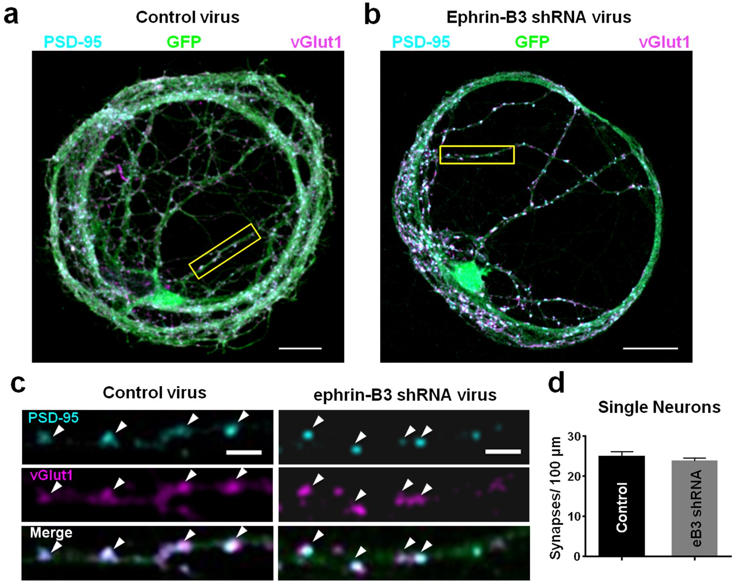 Ephrin B3 Controls Excitatory Synapse Density Through Cell Cell