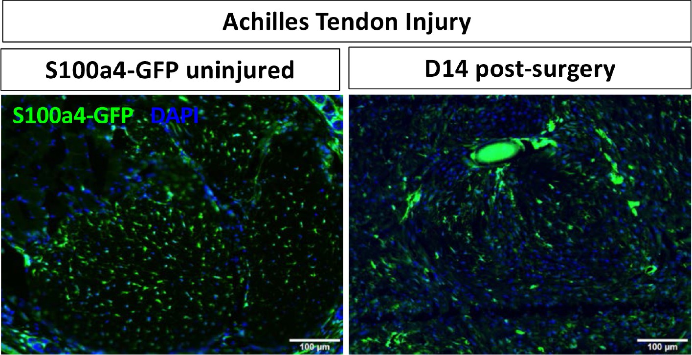 Cell Non Autonomous Functions Of S100a4 Drive Fibrotic Tendon