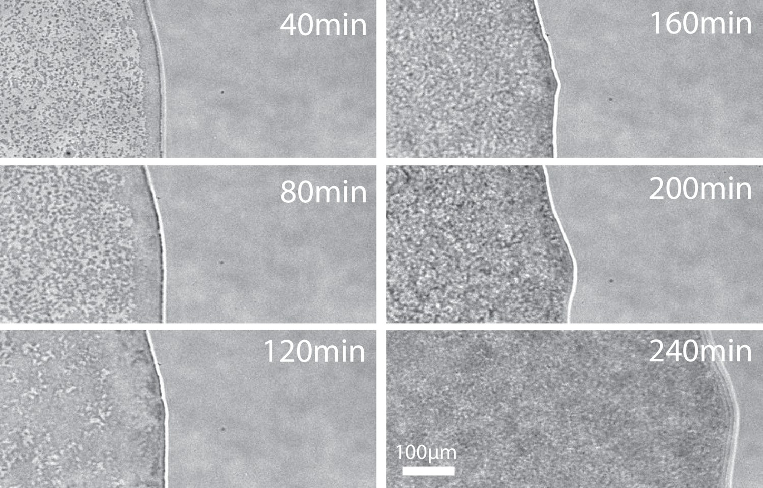 E Coli Under Microscope 10x - Micropedia