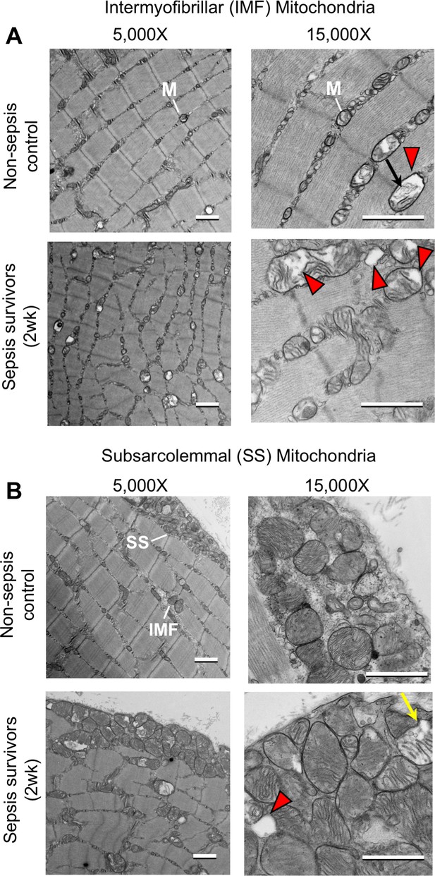 Figures and data in Chronic muscle weakness and mitochondrial