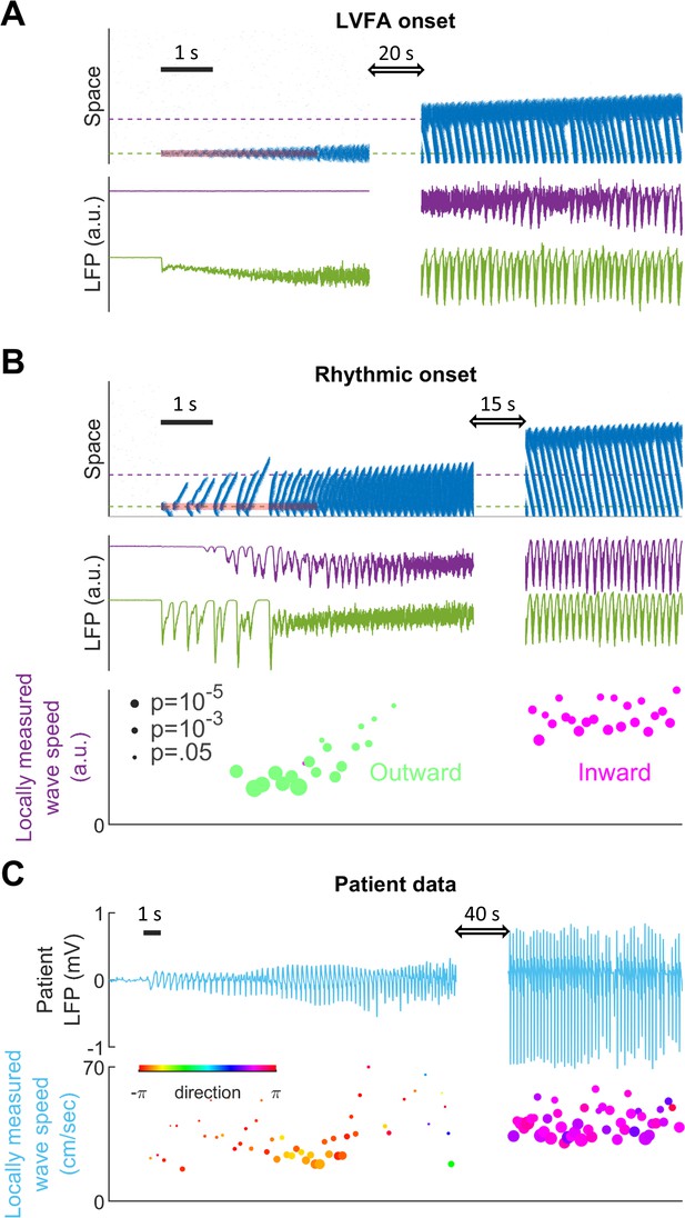 A Model For Focal Seizure Onset, Propagation, Evolution, And ...