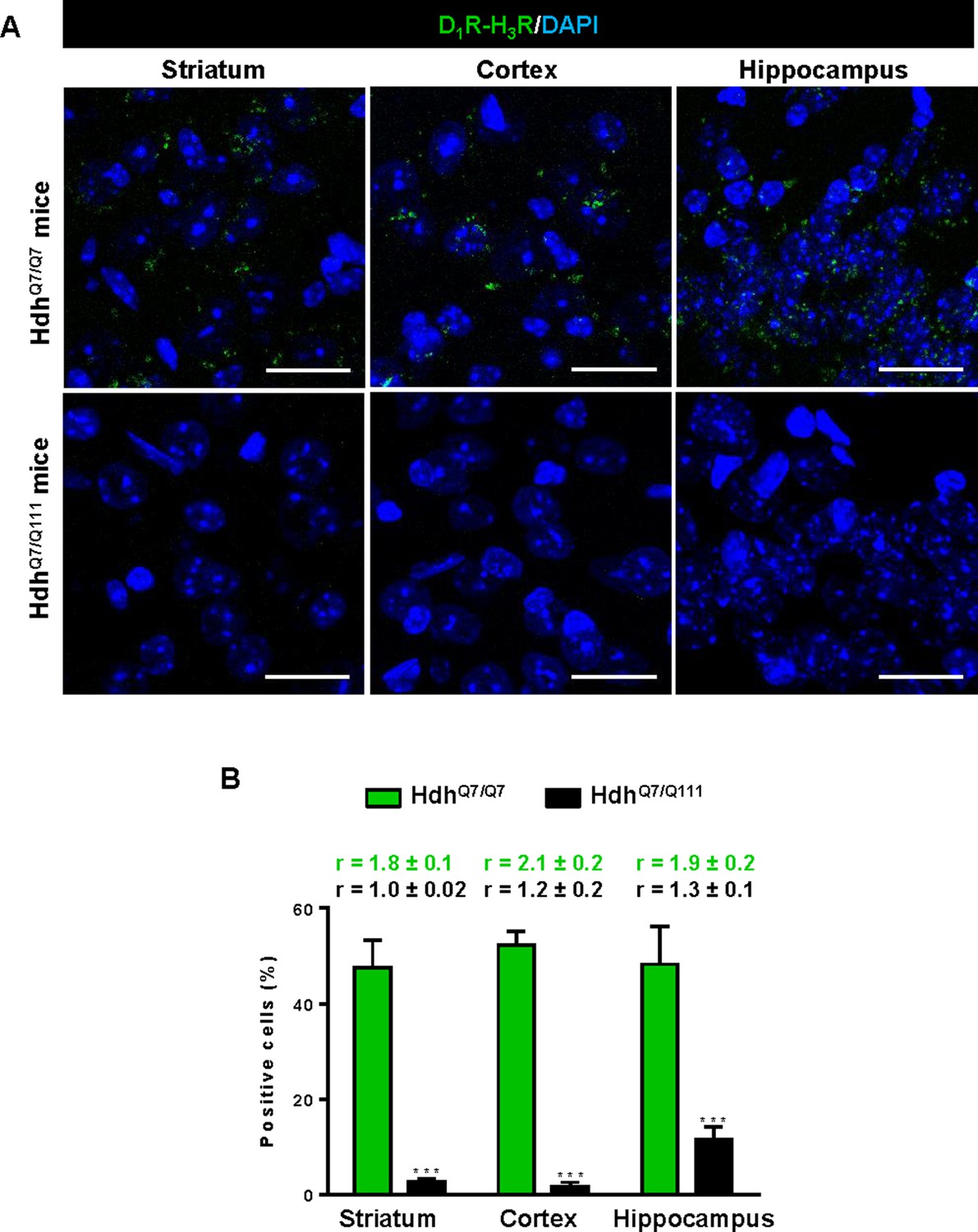 Modulation Of Dopamine D1 Receptors Via Histamine H3 Receptors Is A Novel Therapeutic Target For Huntington S Disease Elife