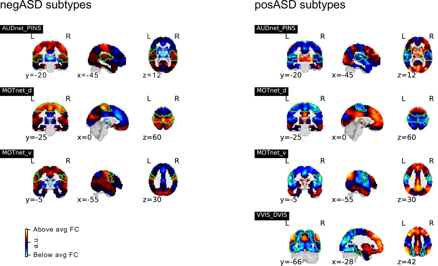 Verschrikking tarief Haarvaten Functional connectivity subtypes associate robustly with ASD diagnosis |  eLife