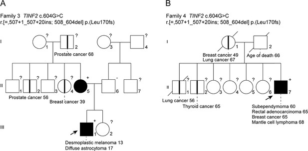 Figures and data in TINF2 is a haploinsufficient tumor suppressor that ...