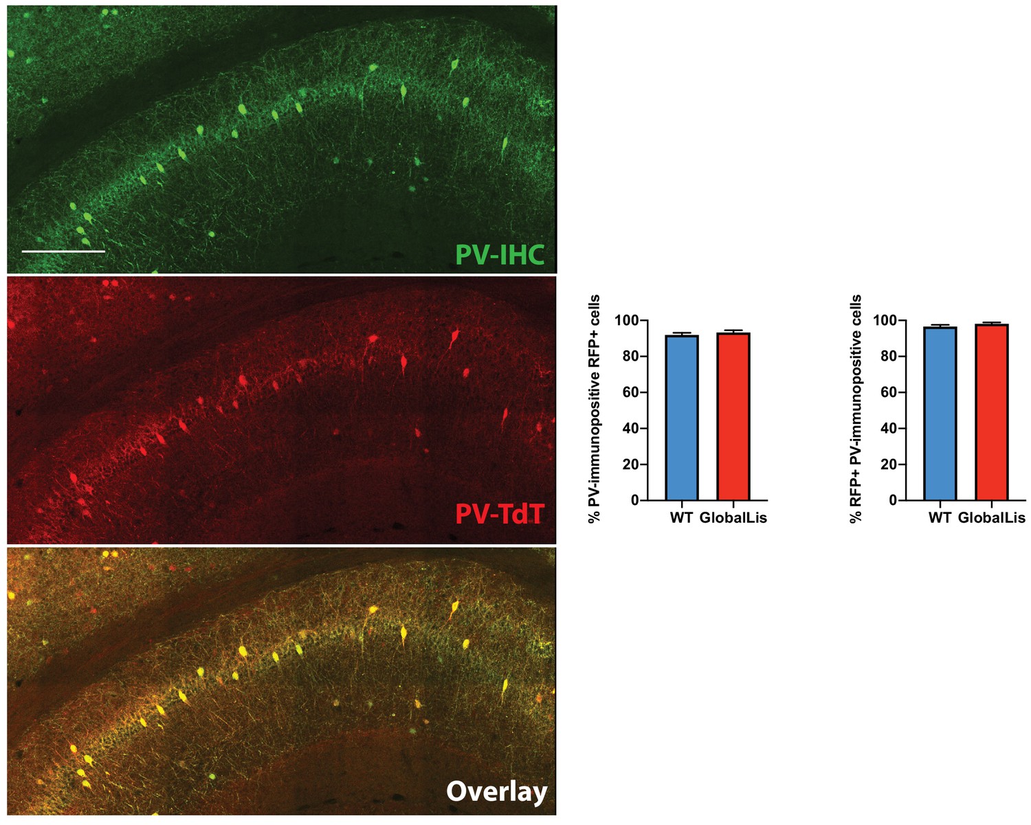 Figures and data in Emergence of non-canonical parvalbumin-containing ...