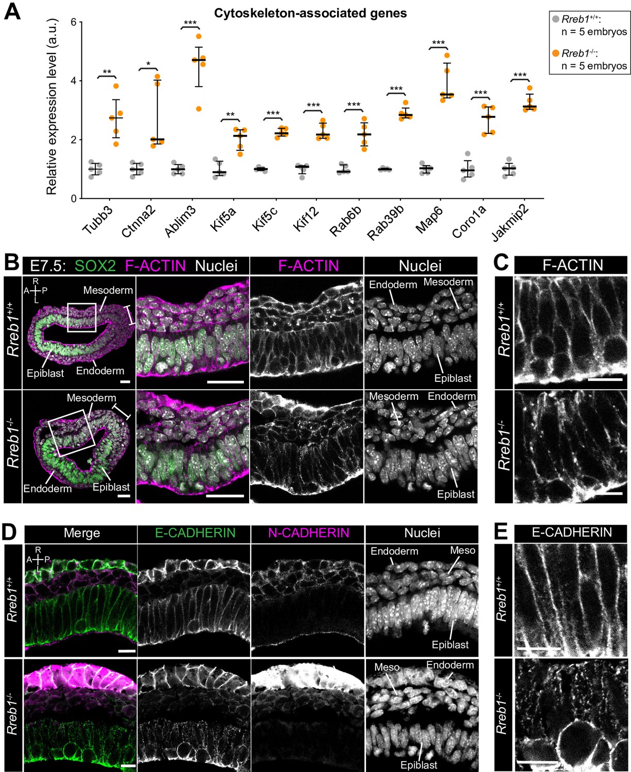The Transcription Factor Rreb1 Regulates Epithelial Architecture Invasiveness And Vasculogenesis In Early Mouse Embryos Elife