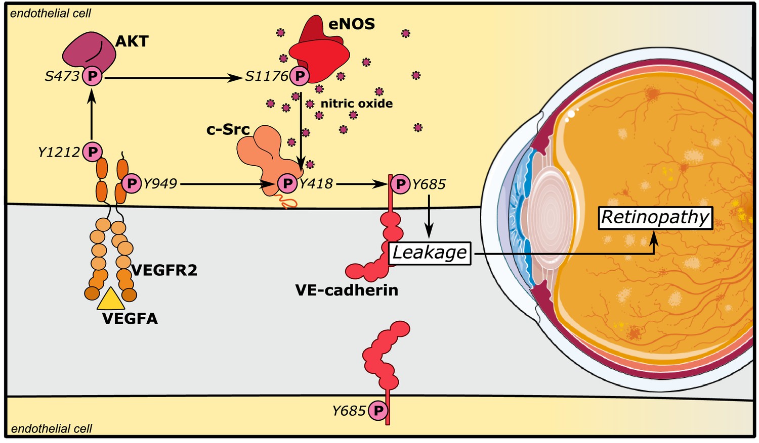 ENOS Induced Vascular Barrier Disruption In Retinopathy By C Src