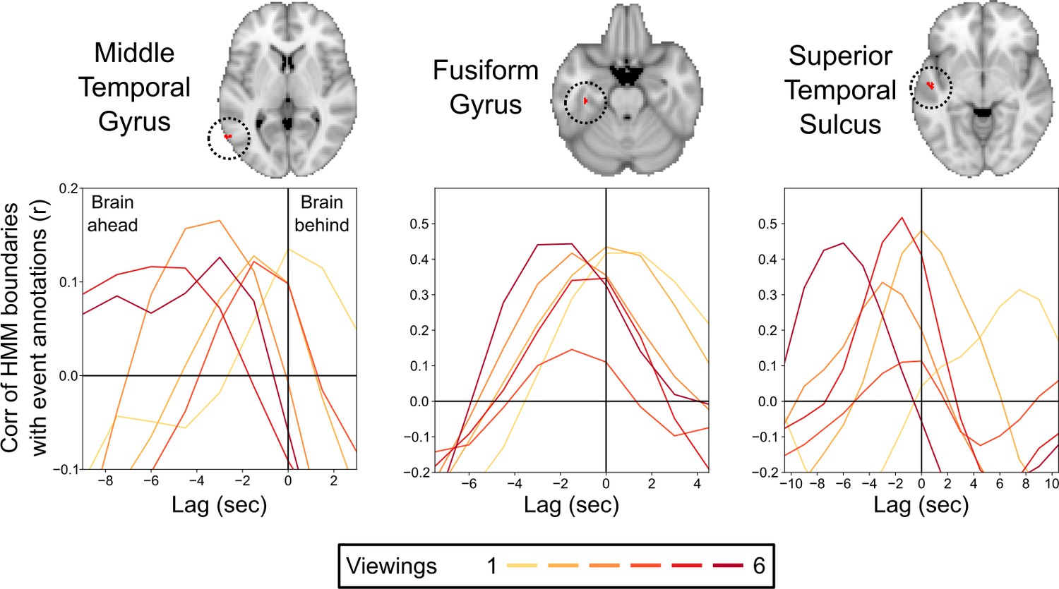 Anticipation Of Temporally Structured Events In The Brain | ELife