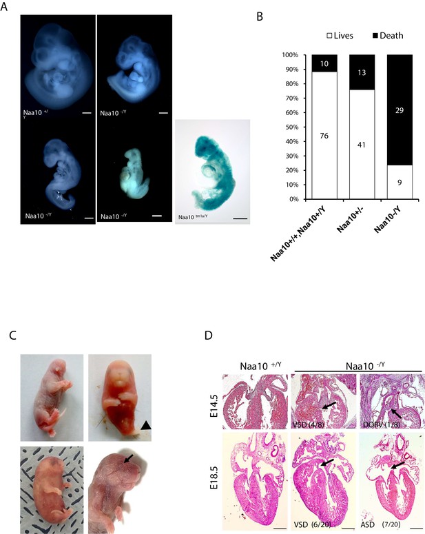 Naa Compensates For Naa In Mice In The Amino Terminal Acetylation