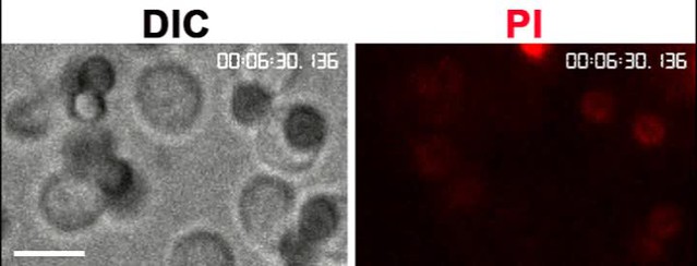 Surface-associated Antigen Induces Permeabilization Of Primary Mouse B ...