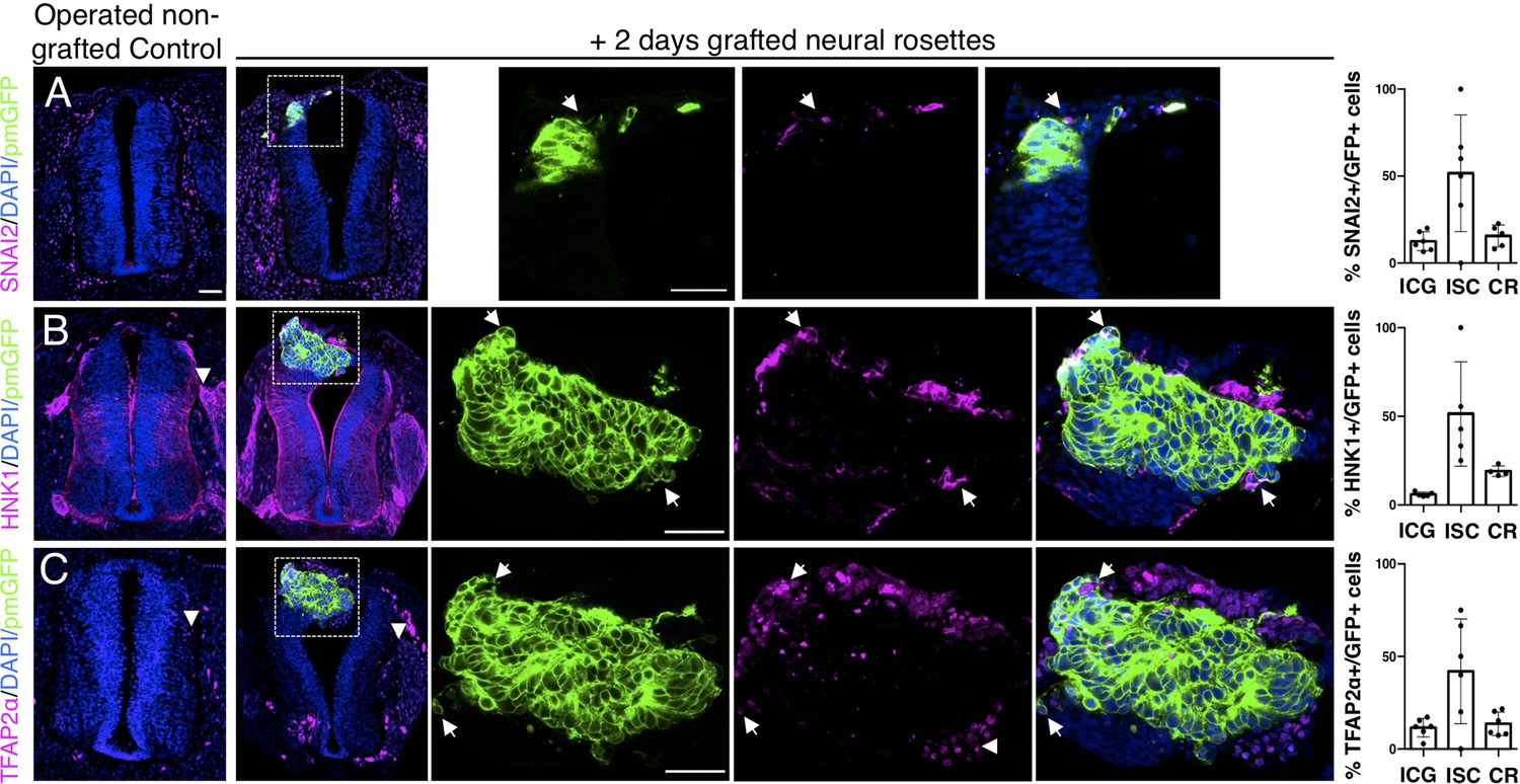 Human Spinal Cord In Vitro Differentiation Pace Is Initially Maintained