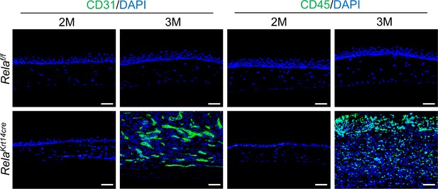 Figures and data in Canonical NF-κB signaling maintains corneal ...