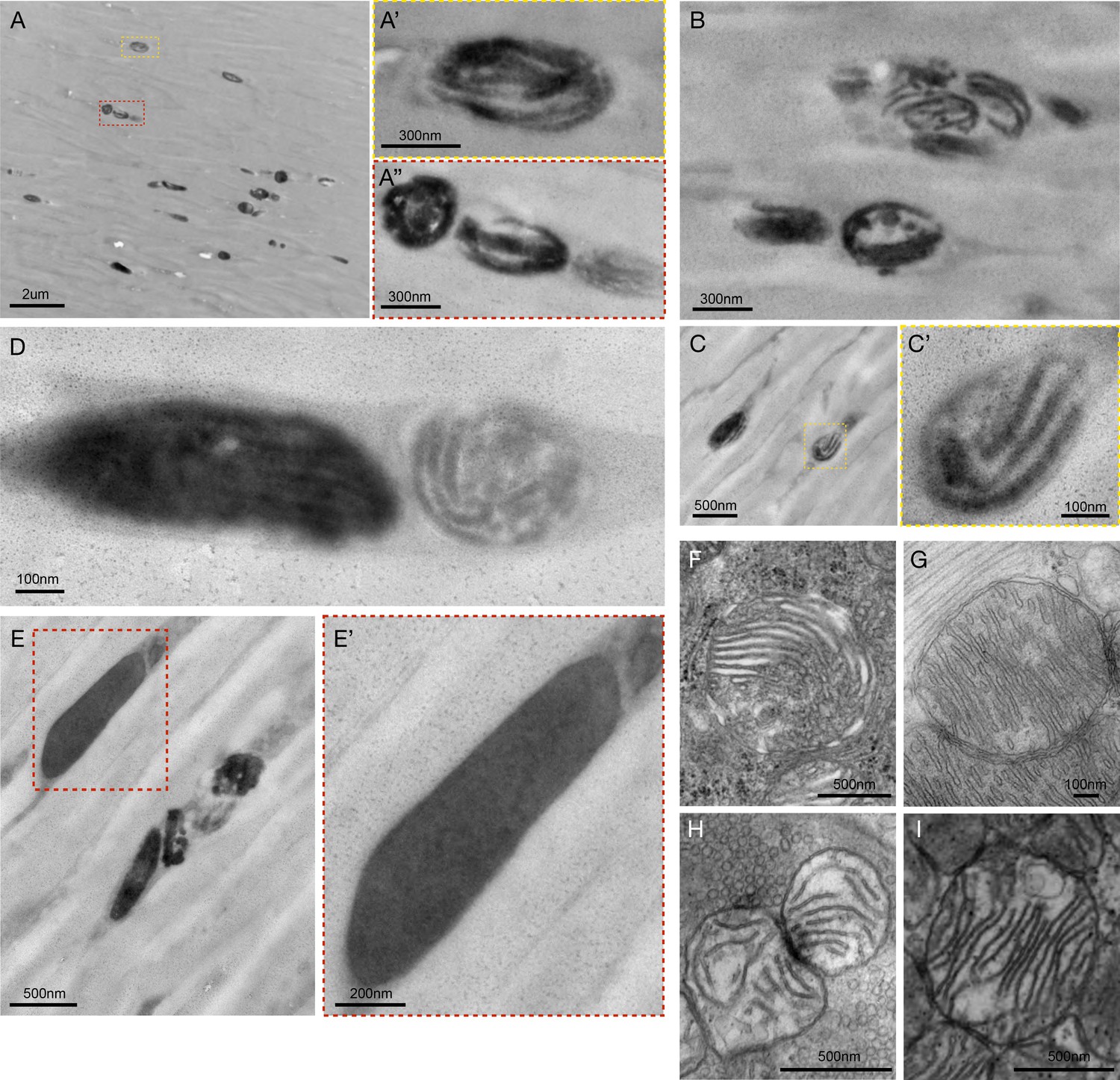 Quantitative Mapping Of Human Hair Greying And Reversal In Relation To Life Stress Elife