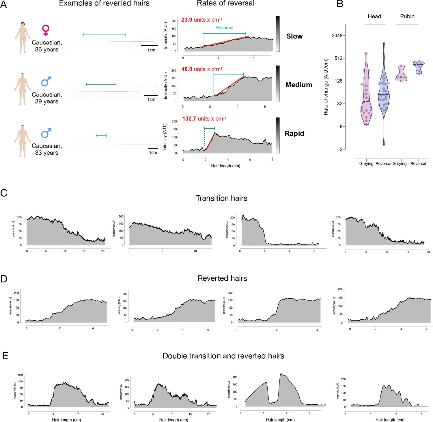 Quantitative Mapping Of Human Hair Greying And Reversal In Relation To Life Stress Elife