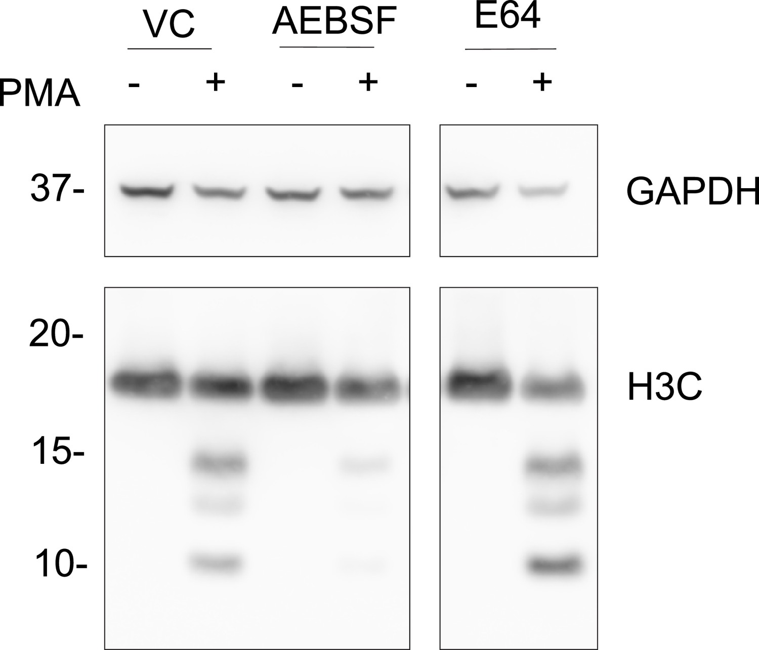 Figures and data in Histone H3 clipping is a novel signature of human ...