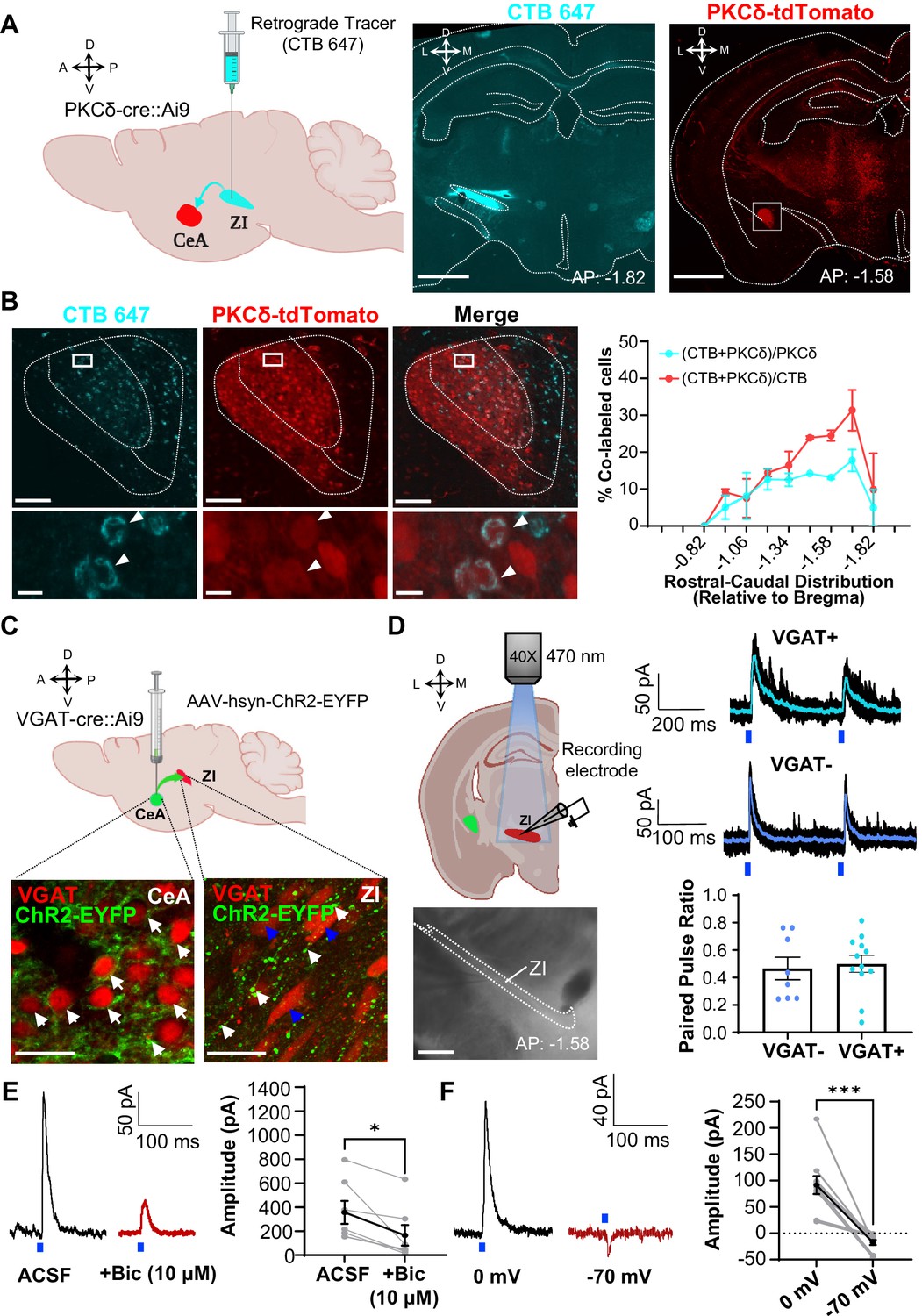 An inhibitory circuit from central amygdala to zona incerta drives pain ...