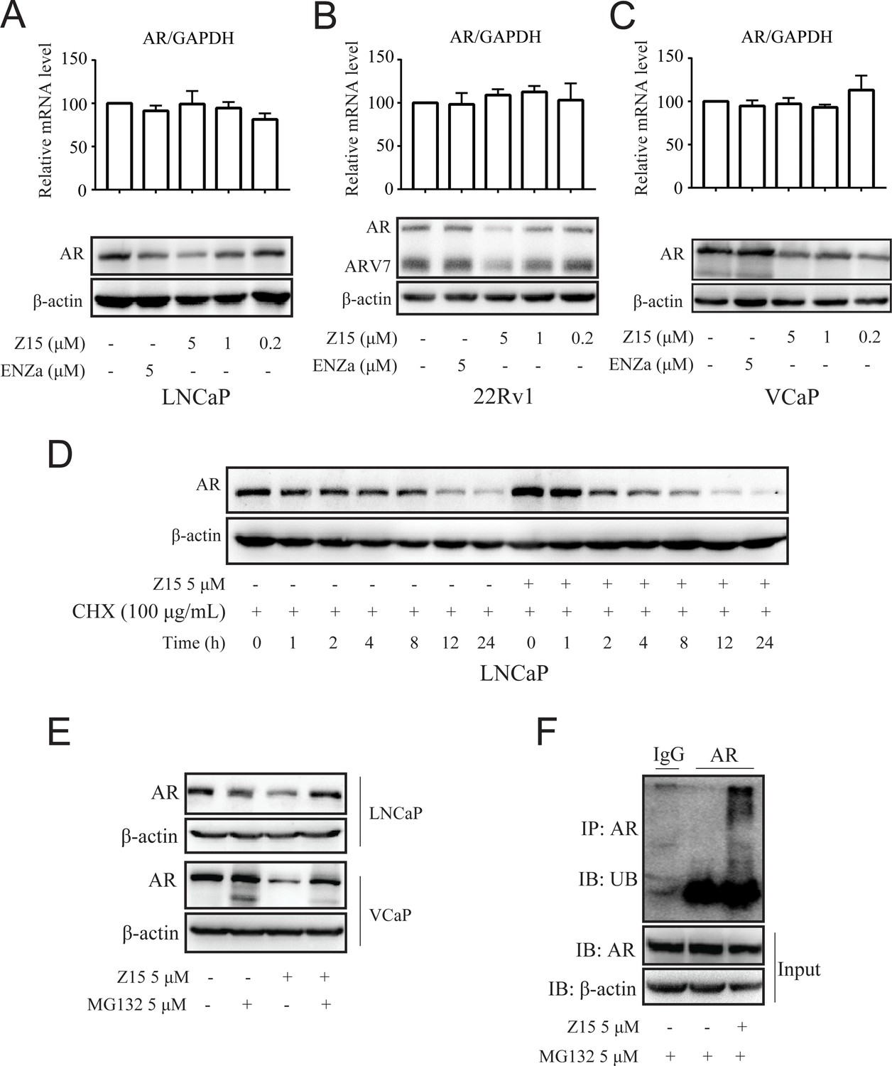 Selective androgen receptor degrader (SARD) to overcome antiandrogen ...