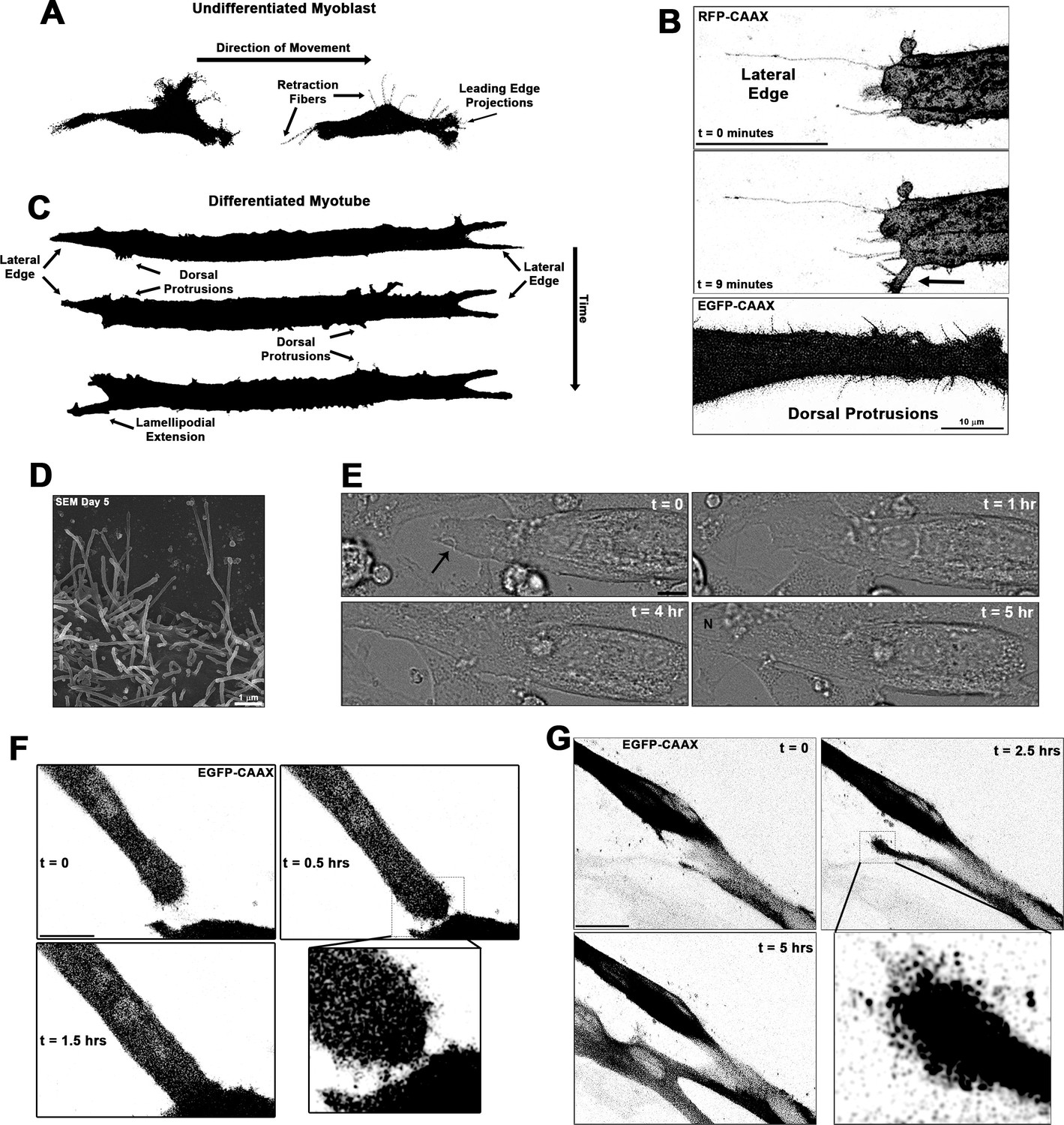 Figures and data in Filopodia powered by class x myosin promote fusion ...