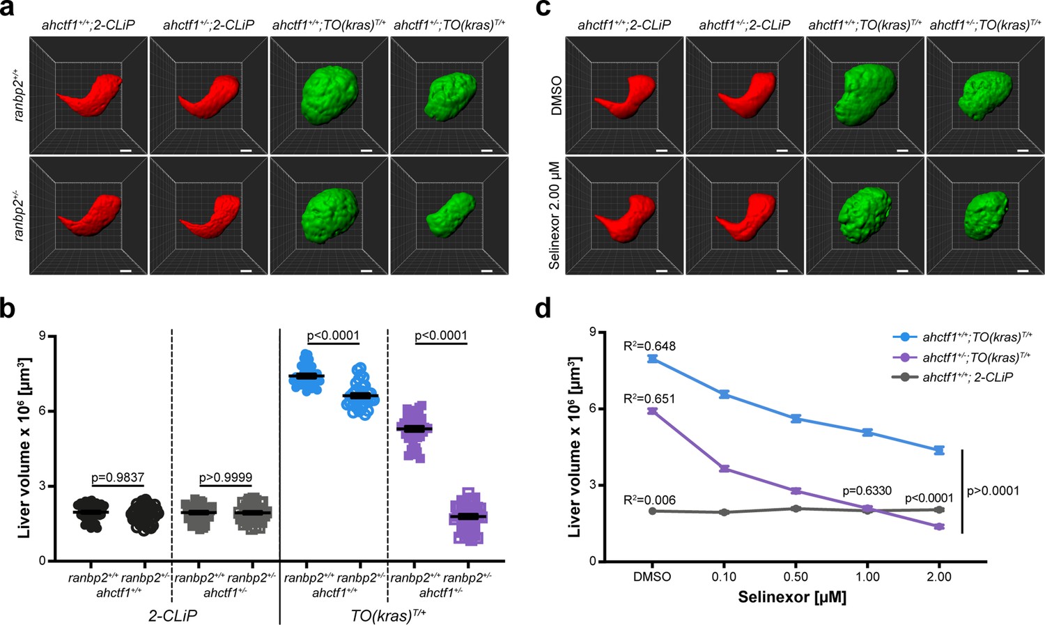 ahctf1 and kras mutations combine to amplify oncogenic stress and