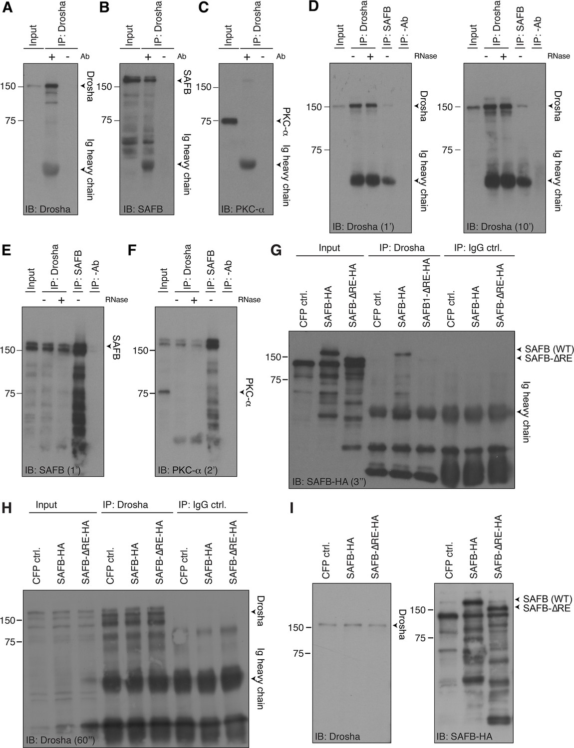 Figures and data in SAFB regulates hippocampal stem cell fate by ...