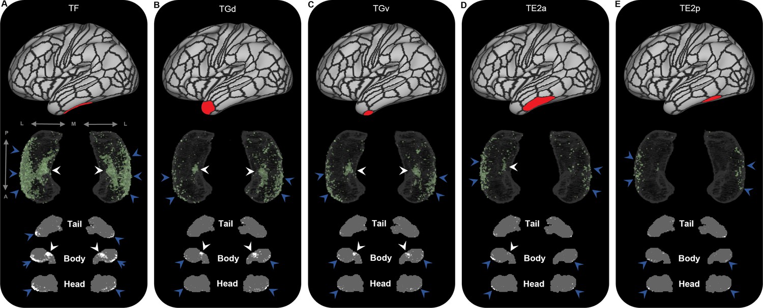 New insights into the brain's motor cortex