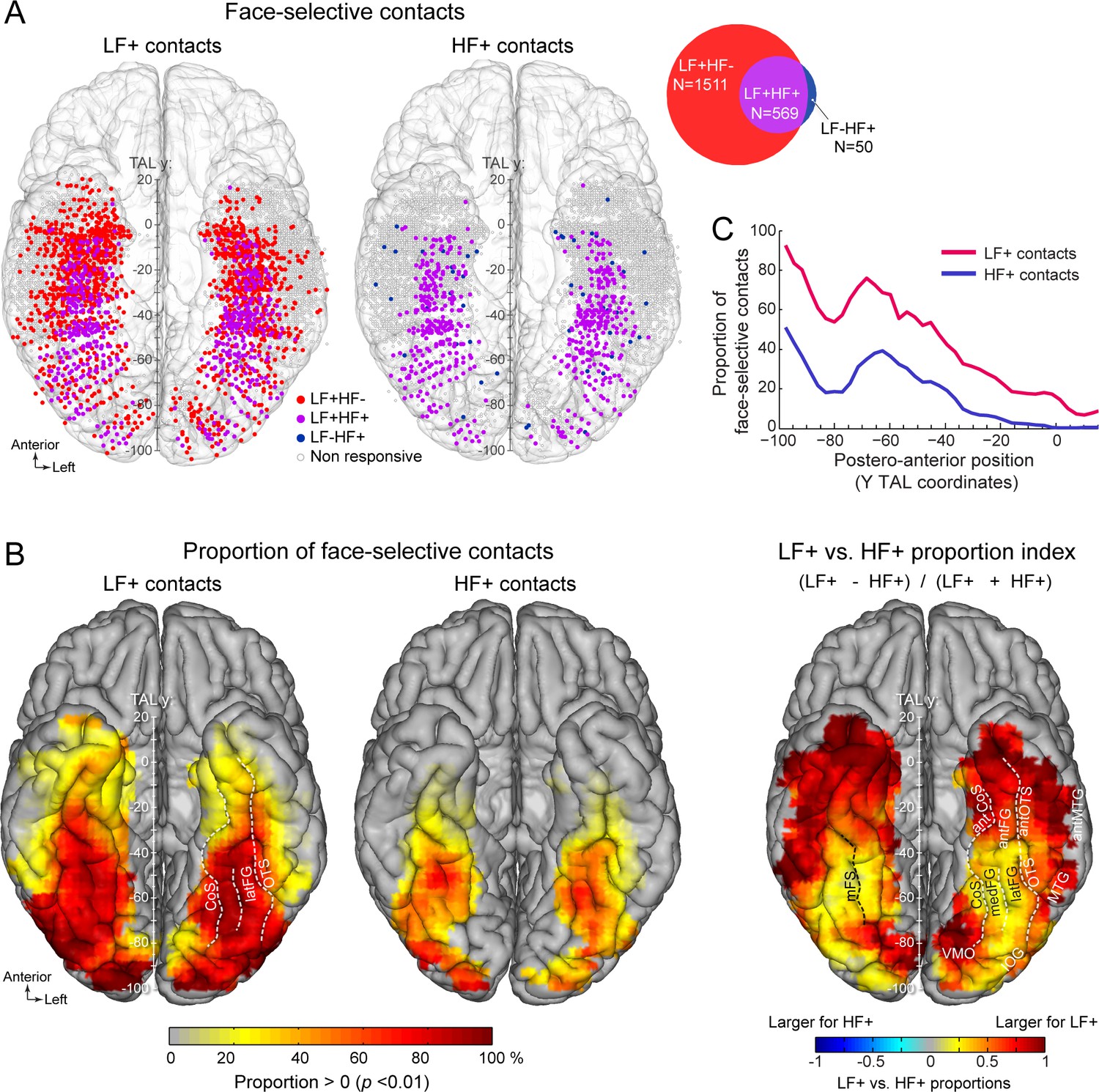 PDF) Decomposing Tool-Action Observation: A Stereo-EEG Study