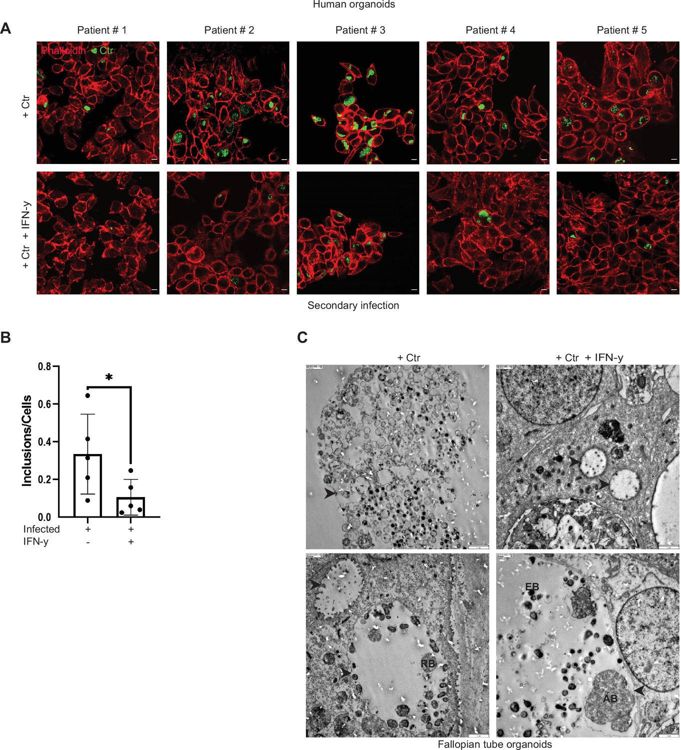 Figures and data in c Myc plays a key role in IFN γ induced persistence