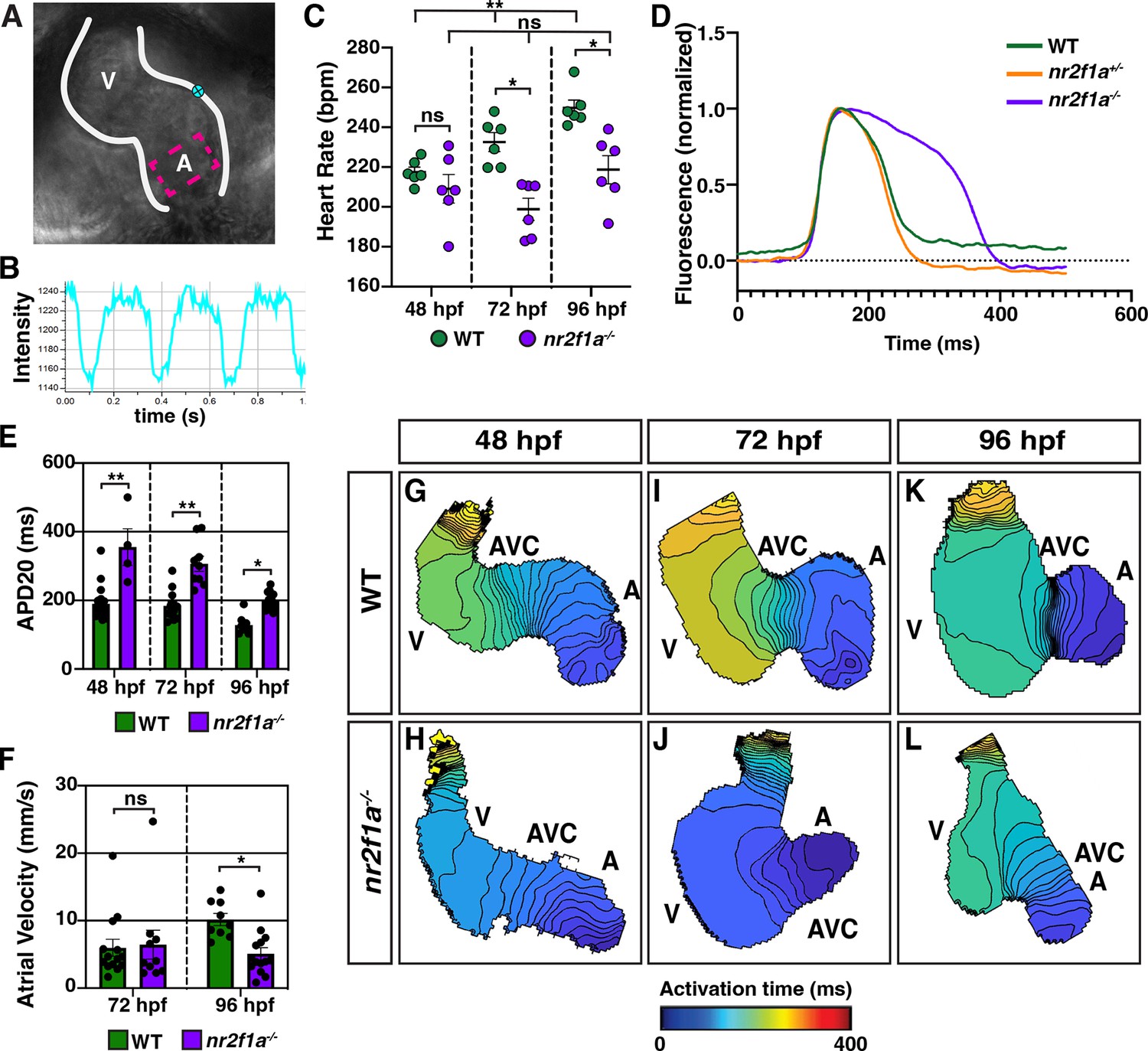 Nr2f1a maintains atrial nkx2.5 expression to repress