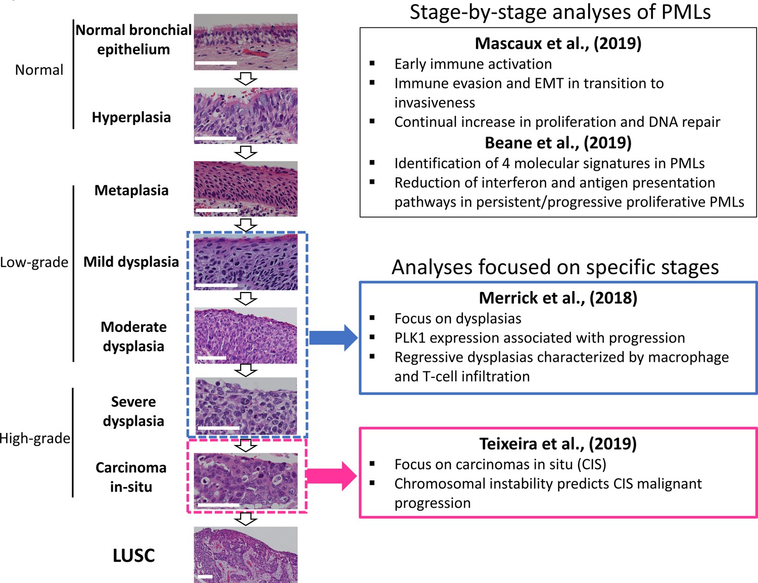 Interrogating The Precancerous Evolution Of Pathway Dysfunction In Lung ...