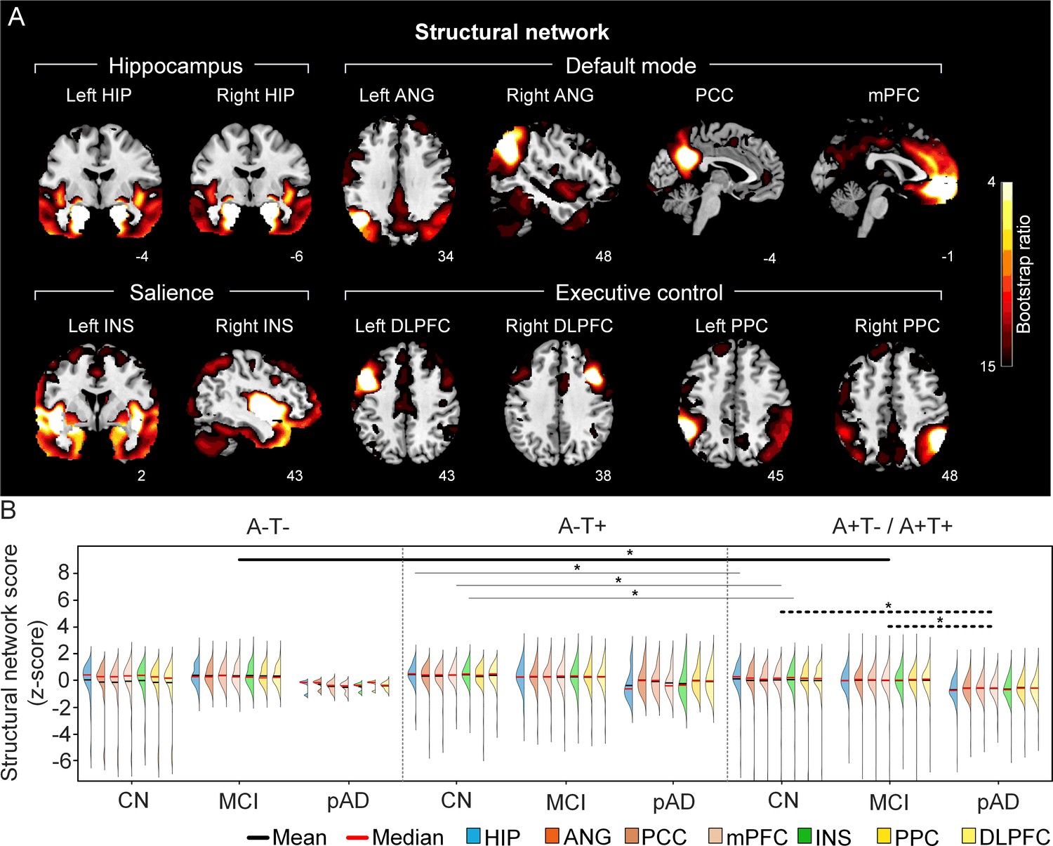 Stage Dependent Differential Influence Of Metabolic And Structural