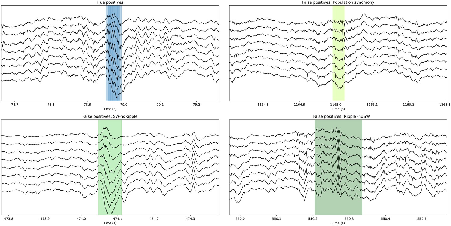 Deep learning-based feature extraction for prediction and ...