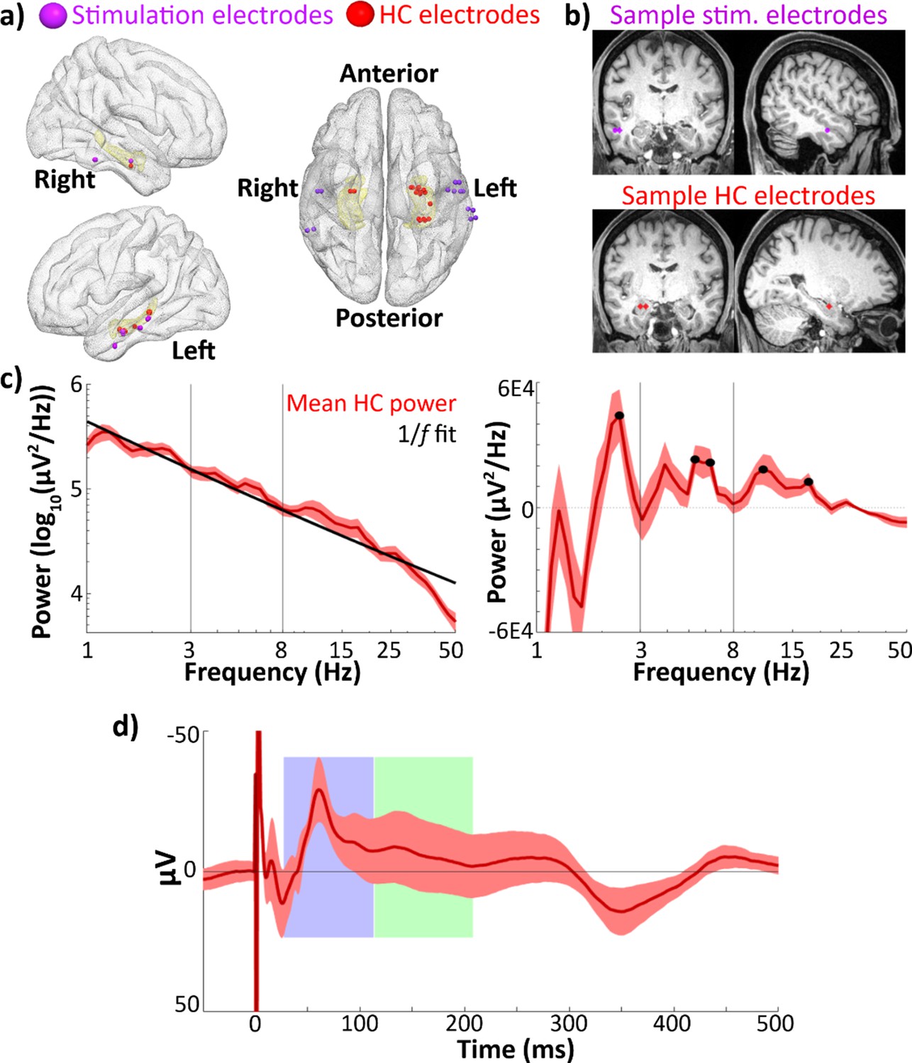 Figures And Data In Human Hippocampal Responses To Network Intracranial