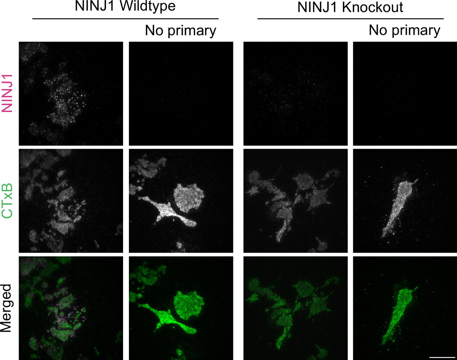 Figures and data in Glycine inhibits NINJ1 membrane clustering to ...