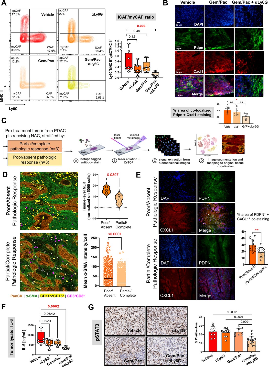 Neutrophil Mediated Fibroblast Tumor Cell Il 6 Stat 3 Signaling Underlies The Association